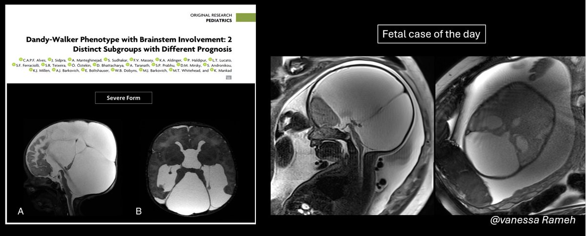 Fetal case of the day! Thank you <a href="/vanessarameh/">Vanessa Rameh, MD</a> for sharing this great fetal case.