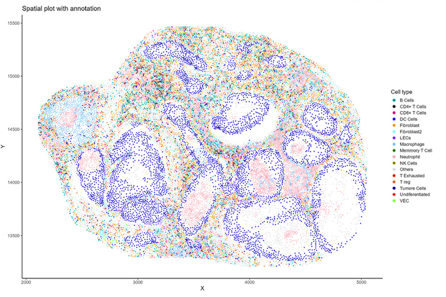 #VCUMassey researchers just developed TACIT, an algorithm revolutionizing cancer diagnosis &amp; treatment! 🧬 It analyzes cell data faster &amp; more accurately for precise care. Learn how this groundbreaking development is changing lives: masseycancercenter.org/news/groundbre… #OneTeamOneFight