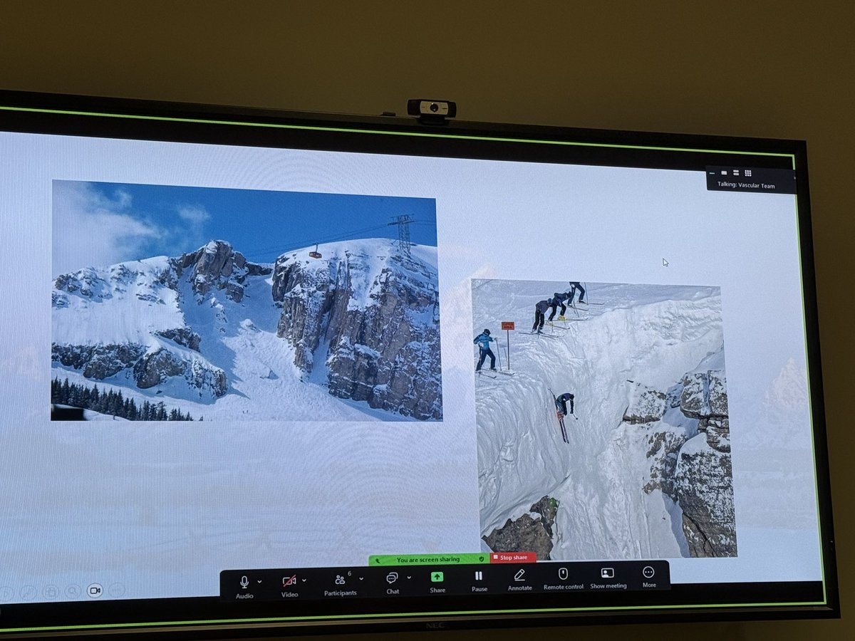 Muhammad Zeeshan (@zee_shan92) on Twitter photo Skiing and Vascular: where stakes are high and perfection is non-negotiable!
Beautiful talk by our graduating chief resident Dr Suggs on her journey from ⛷️ slopes to wires and catheters! <a href="/WashUVascular/">WashU Medicine Division of Vascular Surgery</a> <a href="/WashUSurgery/">WashU Medicine Department of Surgery</a>
#AdrenalineRush
<a href="/zwanken/">Zach Wanken</a> <a href="/westleyohman/">Westley Ohman</a> <a href="/DrPatGeraghty/">Patrick Geraghty</a> Skiing and Vascular: where stakes are high and perfection is non-negotiable!
Beautiful talk by our graduating chief resident Dr Suggs on her journey from ⛷️ slopes to wires and catheters! <a href="/WashUVascular/">WashU Medicine Division of Vascular Surgery</a> <a href="/WashUSurgery/">WashU Medicine Department of Surgery</a>
#AdrenalineRush
<a href="/zwanken/">Zach Wanken</a> <a href="/westleyohman/">Westley Ohman</a> <a href="/DrPatGeraghty/">Patrick Geraghty</a>