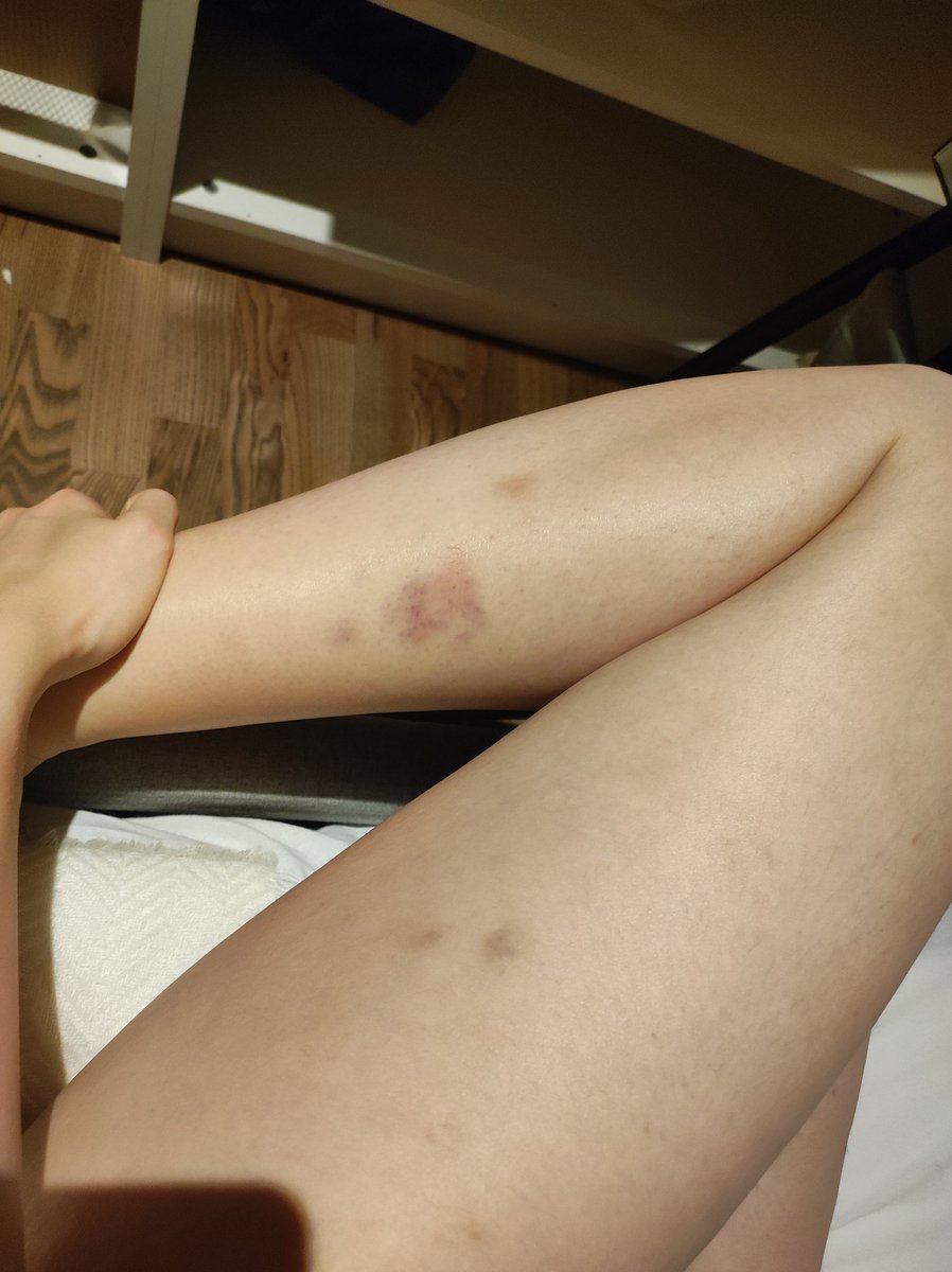 Это я после пилона хд 
Цена красоты