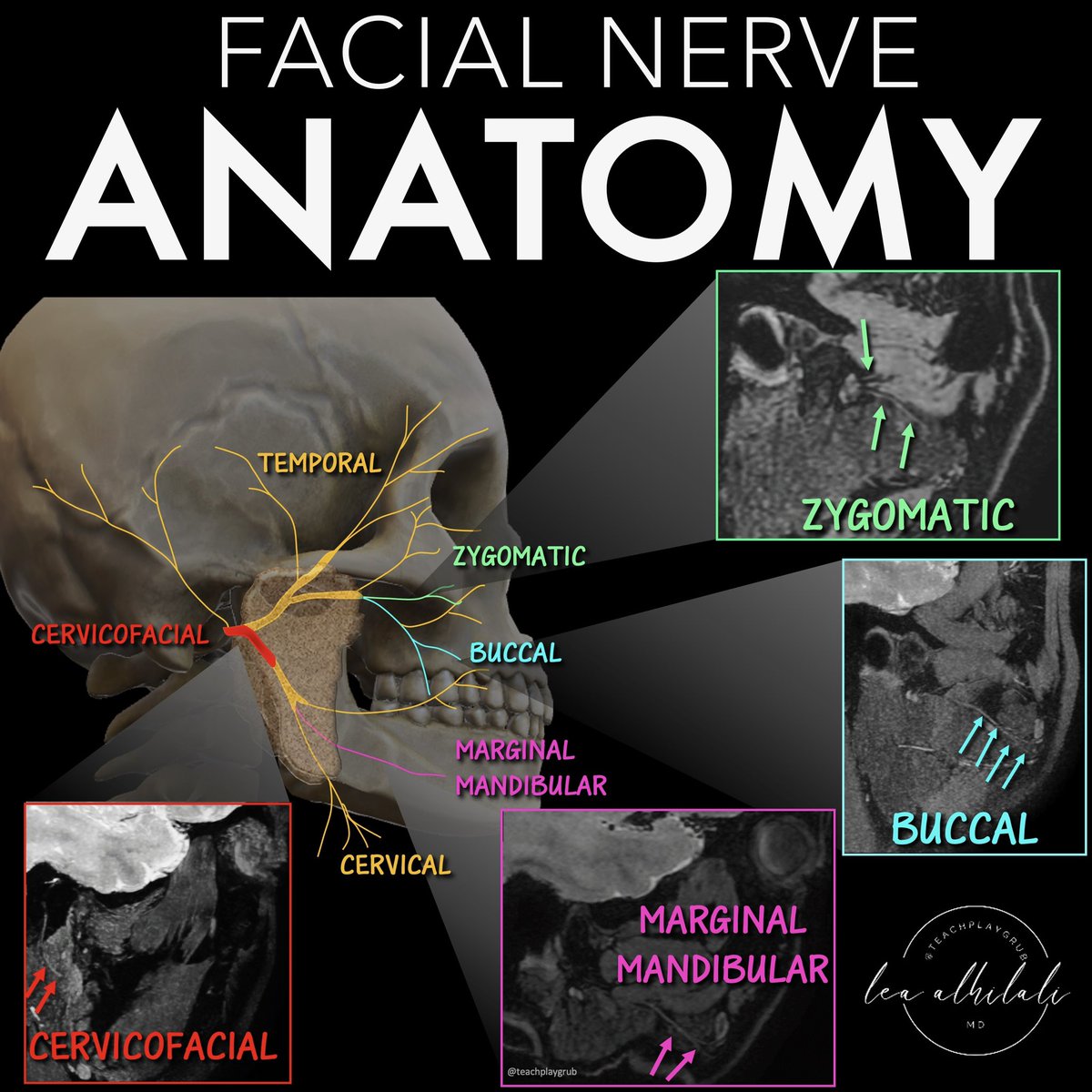To Zanzibar By Motor Car!

You can't get to Zanzibar by motorcar--but you can go beyond the mnemonic to understand facial nerve anatomy!

Its anatomy is a map of facial function &amp; is important for surgery as injuries can be devastating

It has been the greatest challenge of MR