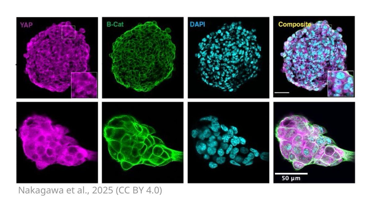 YAP, a protein known to help #cancer cells survive treatment, behaves very differently in cell culture models depending on how they are grown in the lab, highlighting the importance of mimicking tumour architecture to guide better drug strategies.
elifesciences.org/reviewed-prepr…