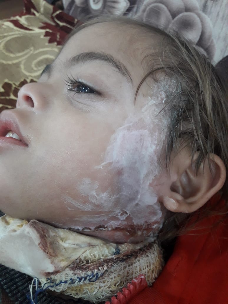 tysyr3619's tweet image. We ask everyone to support Nizar Nizar from countries with special needs I have downloaded a report from the doctor so you can πππunderstand Nizar's condition
Paypal.me/gazaaaaa