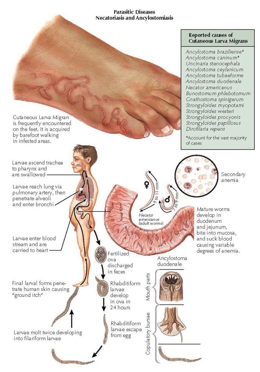 Parasitic Hookworm Ancylosoma Stock Illustration - Illustration of medical,  isolated: 142600846, image size:840x1200