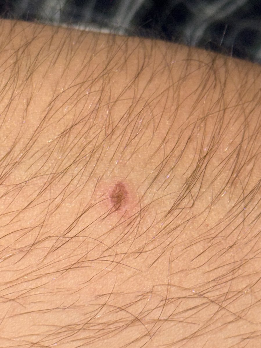 PYROTECHNIK IST DOCH KEIN VERBRECHEN (aber manchmal gibt es dir 1 Autschi 😔)