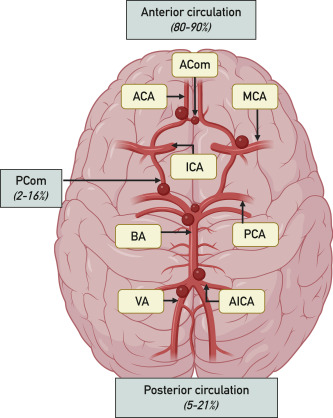 Patients with autosomal dominant polycystic kidney disease have a higher prevalence of Intracranial aneurysms, which poses a significant clinical challenge because of their potential for severe neurologic outcomes.
mayocl.in/3FQSUvI
