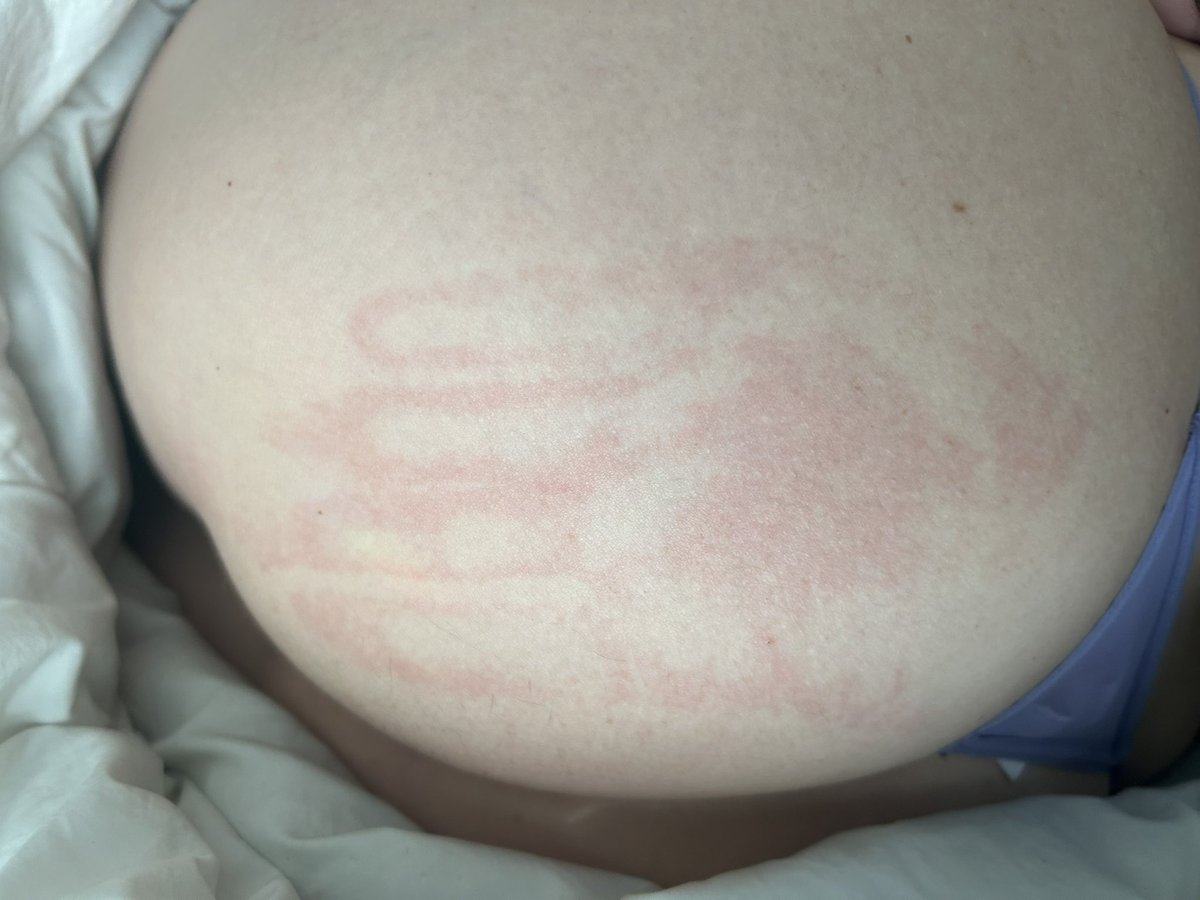 CCocoToes's tweet image. It hurt so good 🤤 his ✋🏿 on my 🍑
Perfect handprint #spank #handprint #hurtssogood