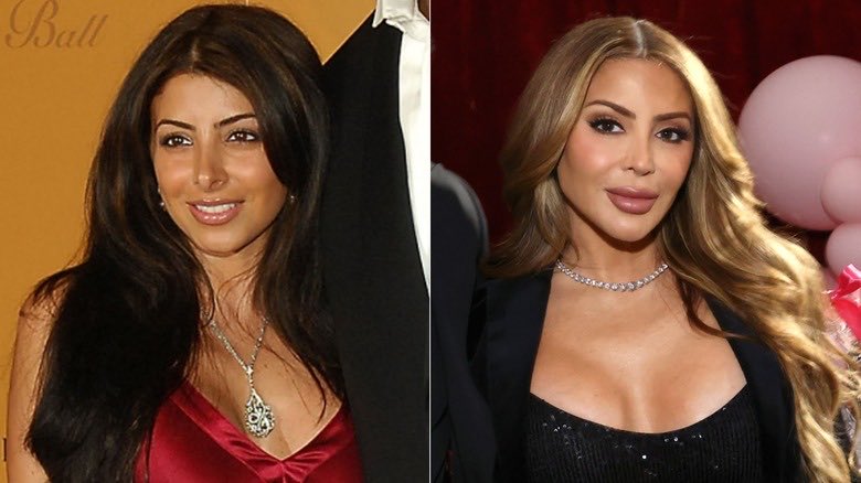 Stingrayomega's tweet image. #RHOM
Larsa was stunning before….smh.