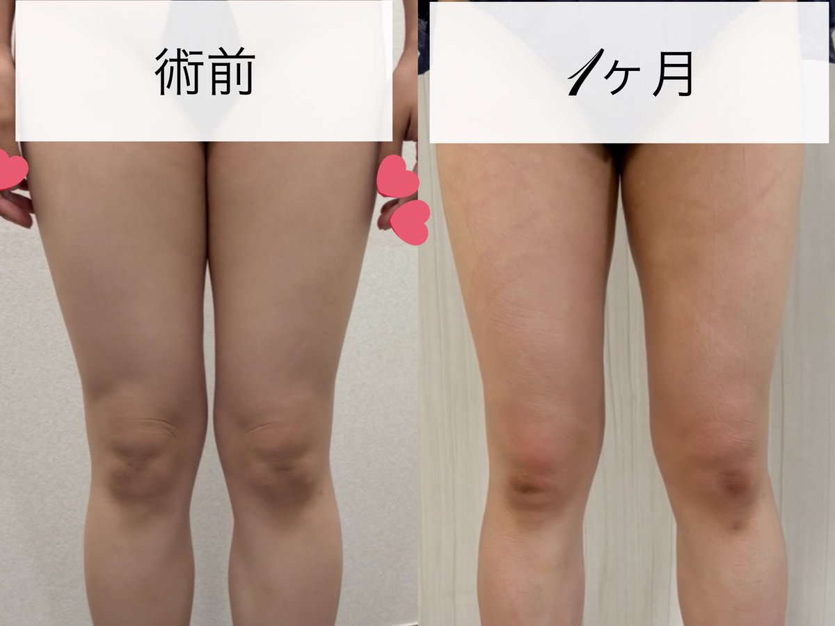 めるる¨̮♡ tweet media
