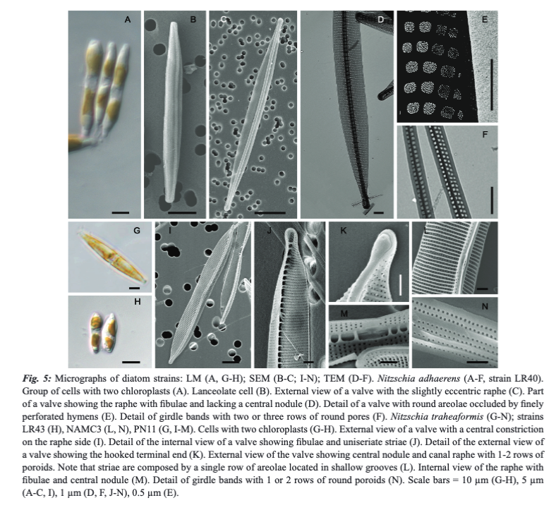 PELUSI, A., ROMERO MARTÍNEZ, M. L., MULE, A., SCALCO, E., BARRENECHEA ANGELES, I., PIREDDA, R., KOOISTRA H.C.F. , W., et. al. Diatom distribution and long-term survival in a heavily polluted sediment core from the Bay of Bagnoli (Tyrrhenian Sea, Italy). doi.org/10.12681/mms.3…