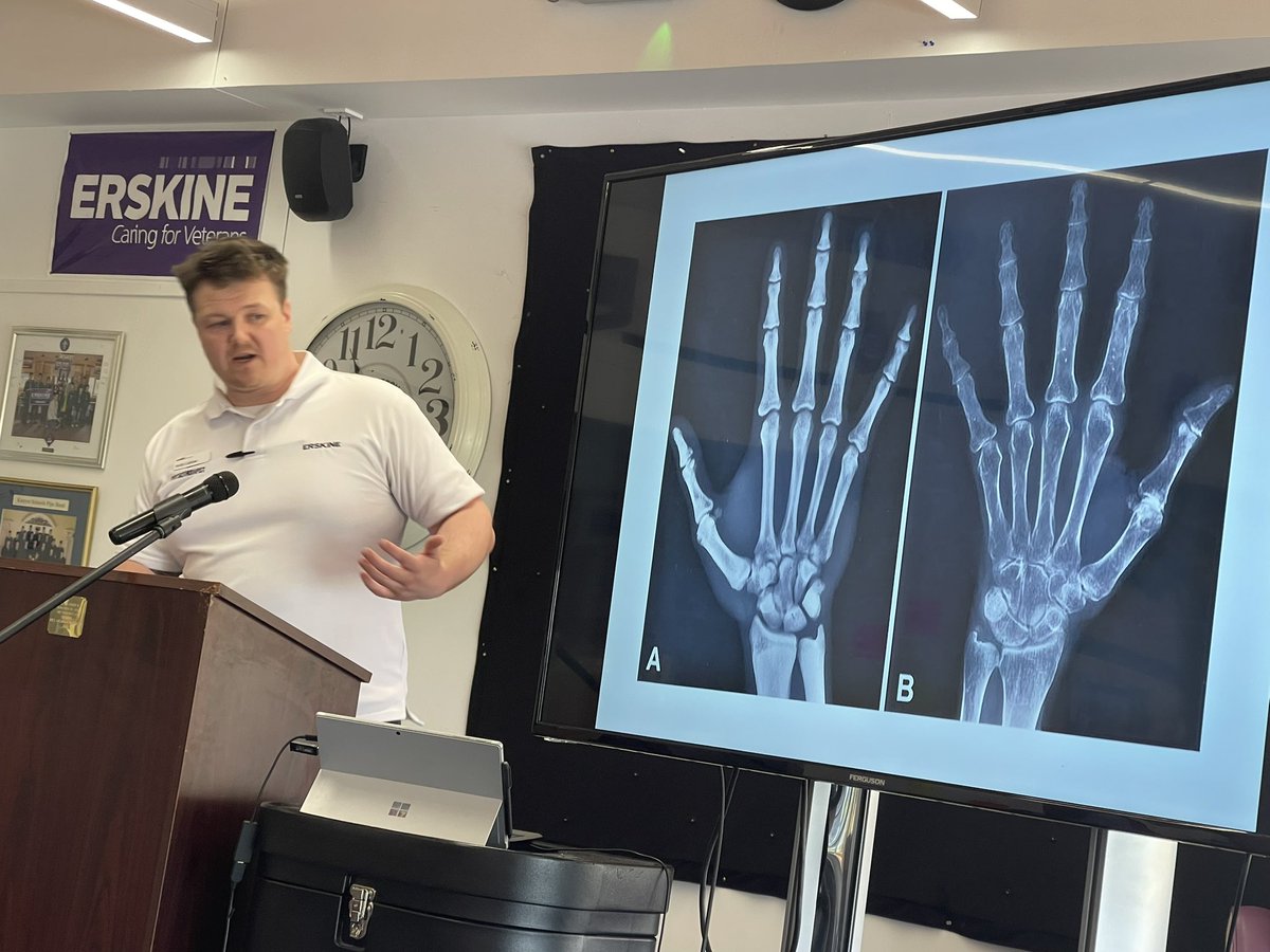 Alison Payne RN CFR (@nsepayne) on Twitter photo <a href="/ErskineCharity/">Erskine Veterans Charity</a> Care Conference in Bishopton has opened I am thrilled to be chair for the morning We have had Helen Henderson talking about the Glasgow Coma Scale and now Andy Caldow talking about Physiotherapy 😊🙌 <a href="/dtbarron/">Derek T Barron RMN FQNIS 🏴</a> #ECC25 <a href="/ErskineCharity/">Erskine Veterans Charity</a> Care Conference in Bishopton has opened I am thrilled to be chair for the morning We have had Helen Henderson talking about the Glasgow Coma Scale and now Andy Caldow talking about Physiotherapy 😊🙌 <a href="/dtbarron/">Derek T Barron RMN FQNIS 🏴</a> #ECC25