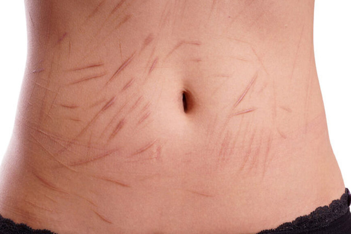 Zombie-aderen\, image size:1200x800