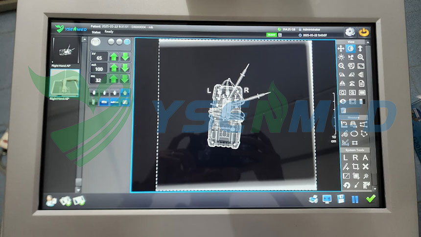 ysenmed's tweet photo. Our distributor from Laos has received another unit recently, and after testing and commissioning, they're all satisfied with the image quanlity.
#ysenmed #Medicalequipment #medicalsupplier #xraysystem #Hospital https://t.co/tfyis9alpS