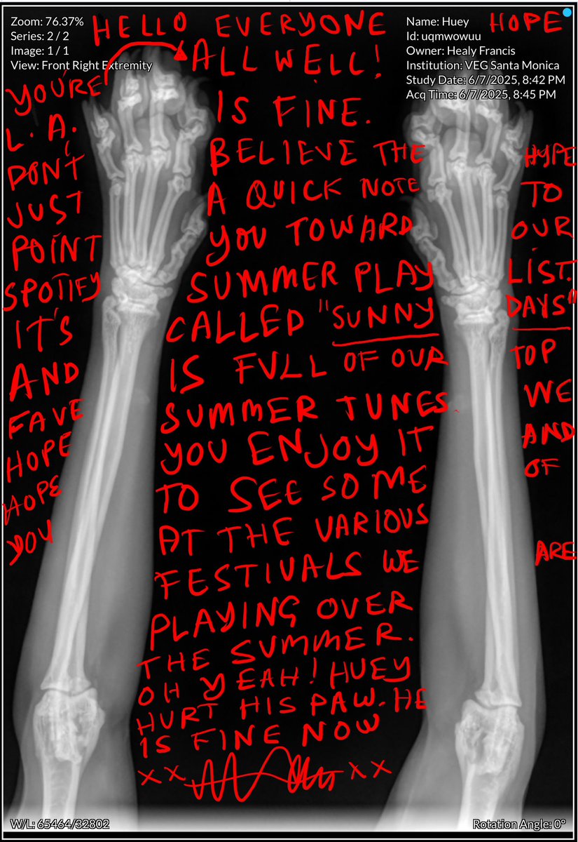 Fran Healy (@franhealy) on Twitter photo 