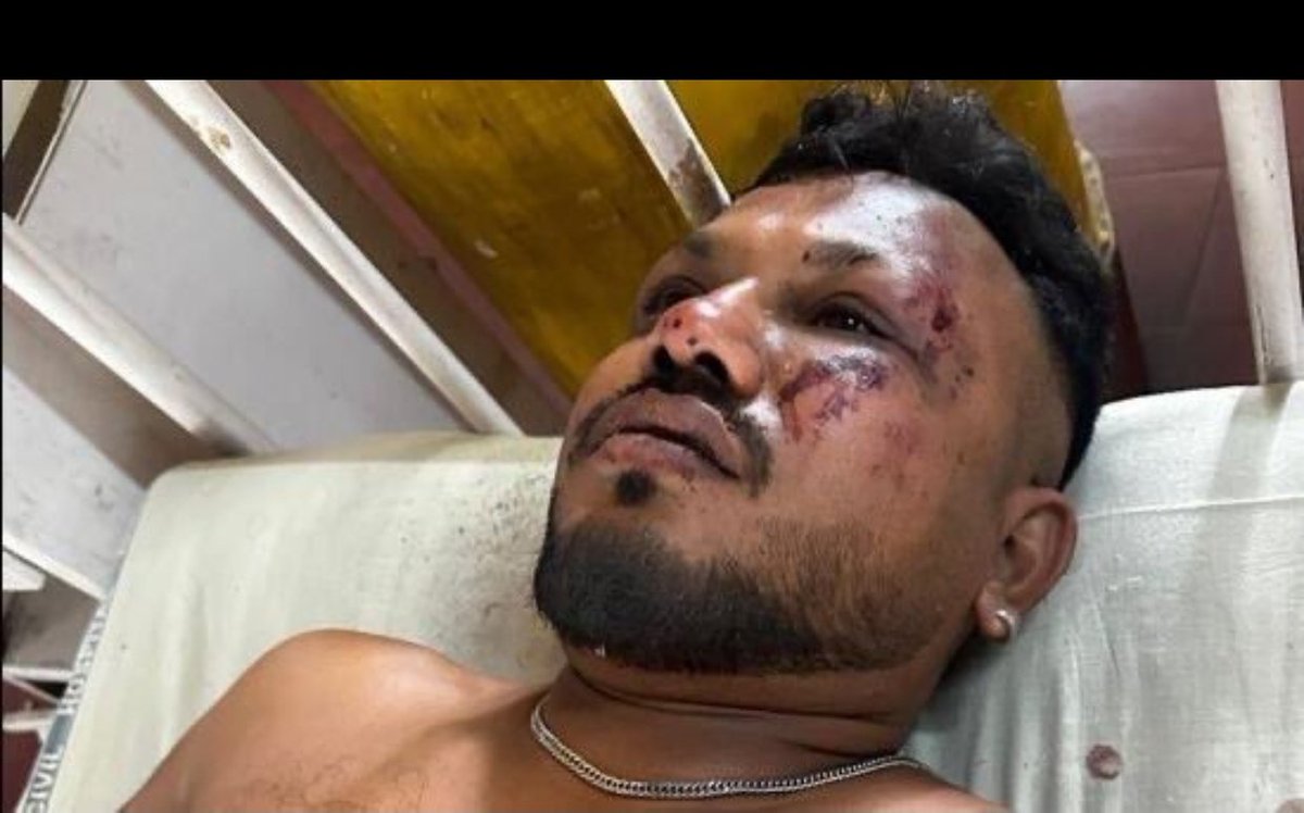 Miracle Survival 
Confirmed survivor of the Air India crash:

40-year-old Vishwash Kumar Ramesh is alive and being treated at Civil Hospital, Asarwa.

Wishing him strength and healing. 🙏

 #planecrash एयर इंडिया