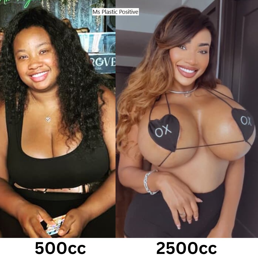 Ms Plastic Positive (@plastic_ms) on Twitter photo Follow <a href="/_tiamaria1/">ππ’ππππ«π’π</a> #plasticsurgery #cosmeticsurgery #BreastAugmentation #bigboobs #bimbogirl #bimbobarbie #bimbo #bimbogoddess #plasticlife #plasticdoll #plasticmakesperfect Follow <a href="/_tiamaria1/">ππ’ππππ«π’π</a> #plasticsurgery #cosmeticsurgery #BreastAugmentation #bigboobs #bimbogirl #bimbobarbie #bimbo #bimbogoddess #plasticlife #plasticdoll #plasticmakesperfect