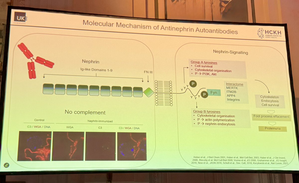 kidneydoc101's tweet image. Stunning presentation by @hengel_f at #podocyteconference 

Defining role of #antinephrin antibodies in #minimalchange and #FSGS

From brilliant early observations from @AstridWeins to reliable measurement to proof of causality &amp;amp; prognostic importance 

👏🏻👏🏻

@ISGDtweets