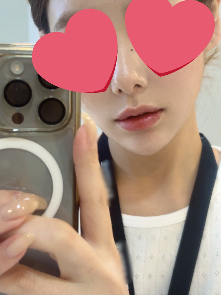 it_susang's tweet photo. 昼休み使って会社近くのNANA美容外科で初の唇ヒアルしてきた👄
理想の形とか特になくて、こんな感じの自然な感じがいいです！って症例写真見せて伝えたら、施術直後から自然なボリューム感…完璧すぎる🤝🏻✨
様子見て、残った分追加で入れてもらうか迷う🥹 https://t.co/On3T6Bq3zD