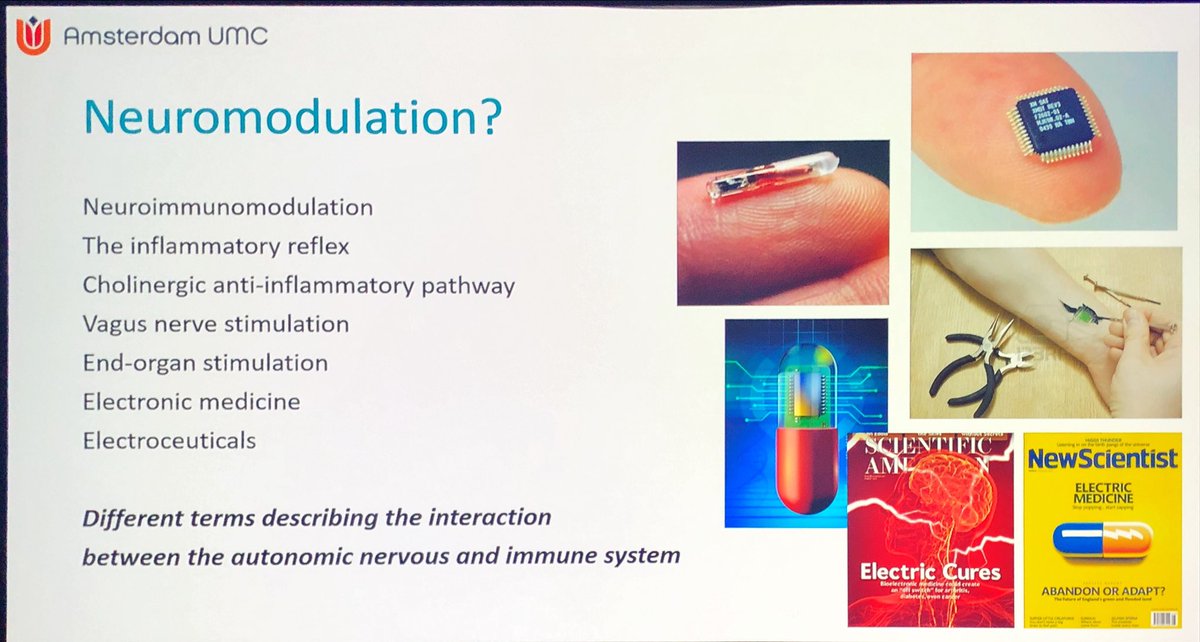 Janetbirdope's tweet image. #neuromodulation in #rheumatoid #arthritis 

What is it? 
👇
Autonomic &amp;amp; immune system interaction 

Who seeks this Rx?
desperate pts w pain
No Rx left 
Interested in technology

#EULAR2025 @RheumNow @eular_org 
#D2T #RA