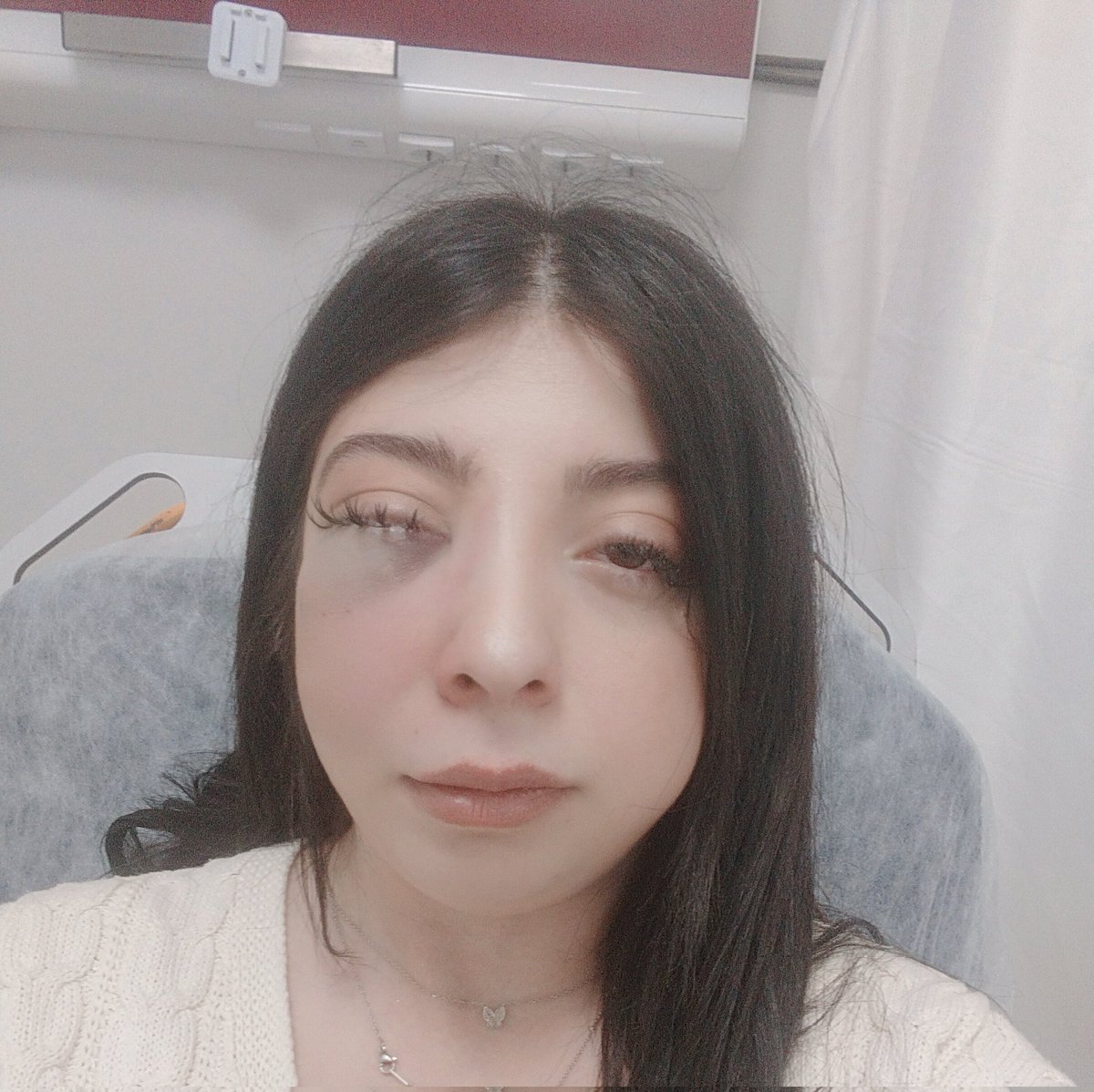 sadecedaamla's tweet photo. Tahliye kararı çıkarken bu suratım gözümün önündeydi.Kaç aydır yaşadığım sorunları ben biliyorum.
Ağlamalarım,sinir krizleri, bayılmalarım.Çalışamadığım için maddi zararları.Hiçbiriniz bunları yaşamadı.Şimdi üstüne salındı.Benim psikolojim ne olacak söyleyin+ https://t.co/PS9aKCS06p