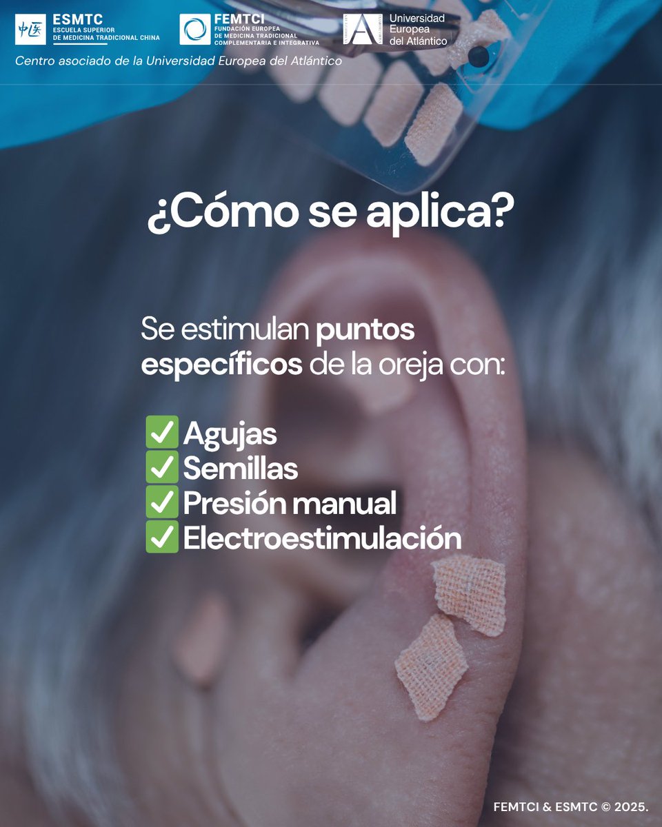 👂 La auriculoterapia regula dolor, ansiedad o insomnio a través del oído, que refleja todo el cuerpo según la MTC.

🎓 En <a href="/esmtc/">Edward Mitchell</a>.es es parte clave del enfoque clínico.

🌿 Desde @femtci defendemos su uso seguro y basado en evidencia.

#Auriculoterapia #FEMTCI #Tratamientos #MTC