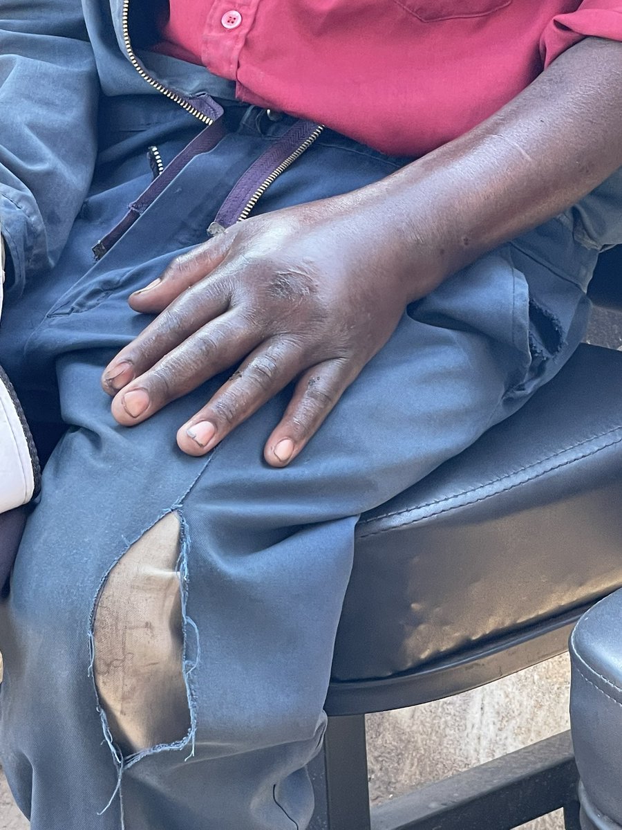 Burora Herbert Anderson (@harderhb) on Twitter photo This innocent man Mutooro, real names Baguma Sharif, a resident of Kisaasi Central was beaten by a <a href="/NUP_Ug/">National Unity Platform</a> supporter in an argument where he asserted that the President of Uganda is <a href="/KagutaMuseveni/">Yoweri K Museveni</a> not <a href="/HEBobiwine/">BOBI WINE</a>. While we can tolerate our political differences respectfully, This innocent man Mutooro, real names Baguma Sharif, a resident of Kisaasi Central was beaten by a <a href="/NUP_Ug/">National Unity Platform</a> supporter in an argument where he asserted that the President of Uganda is <a href="/KagutaMuseveni/">Yoweri K Museveni</a> not <a href="/HEBobiwine/">BOBI WINE</a>. While we can tolerate our political differences respectfully,