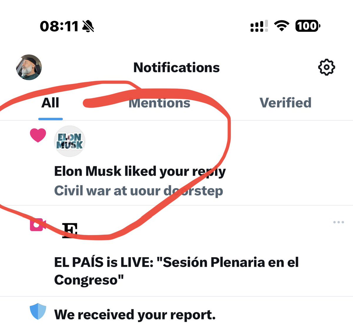 🤮🤮🤮🤮🤮🤮🤮🤮