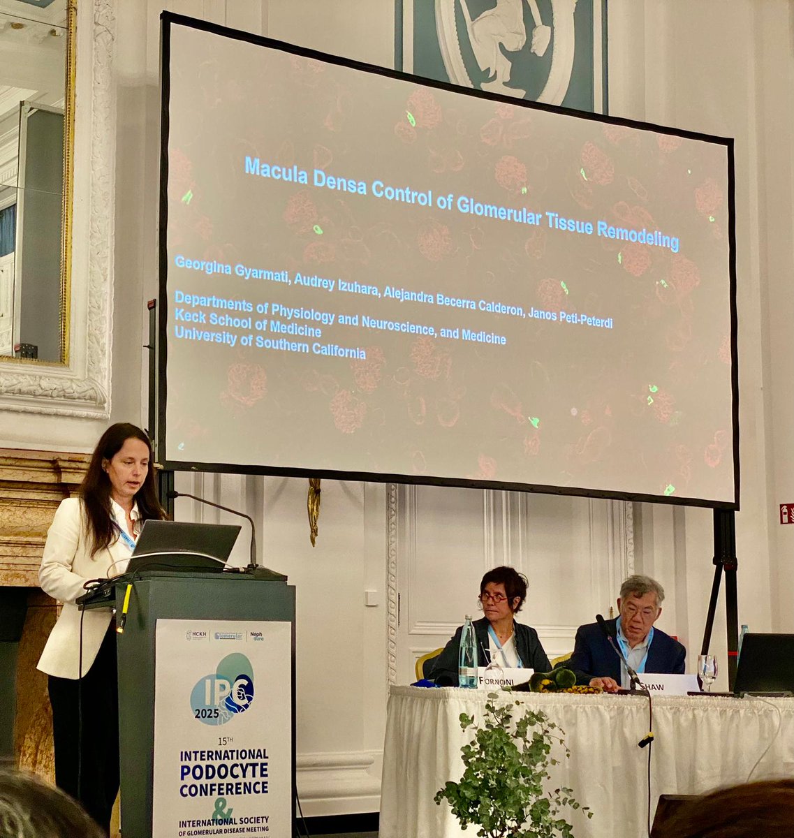 International Society of Glomerular Disease (@isgdtweets) on Twitter photo π¨ Best Abstract Session Alert π¨ #PodocyteConference π
Spectacular session by <a href="/gyarmatigina/">Georgina Gyarmati</a> on Macula Densa nephron-remodelling capacity and targeting potential in CKD! π <a href="/PodocyteIPC/">International Podocyte Conference</a> <a href="/Tobias_B_Huber/">Tobias B. Huber</a> <a href="/KSusztak/">Katalin Susztak</a> <a href="/JochenReiser/">Jochen Reiser MD PhD</a> <a href="/rkramann/">Rafael Kramann, MD PhD</a> π¨ Best Abstract Session Alert π¨ #PodocyteConference π
Spectacular session by <a href="/gyarmatigina/">Georgina Gyarmati</a> on Macula Densa nephron-remodelling capacity and targeting potential in CKD! π <a href="/PodocyteIPC/">International Podocyte Conference</a> <a href="/Tobias_B_Huber/">Tobias B. Huber</a> <a href="/KSusztak/">Katalin Susztak</a> <a href="/JochenReiser/">Jochen Reiser MD PhD</a> <a href="/rkramann/">Rafael Kramann, MD PhD</a>