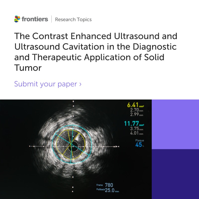 FrontOncology's tweet image. ⏳ 1 month until submissions close! 

 Submit to our Research Topic on how contrast ultrasound &amp;amp; cavitation are advancing solid tumor diagnosis and therapy.
👉 fro.ntiers.in/3U7W 

Editors Jifan Chen, Jean-Michel Escoffre, Hang Zhou
 #callforpapers #openaccess