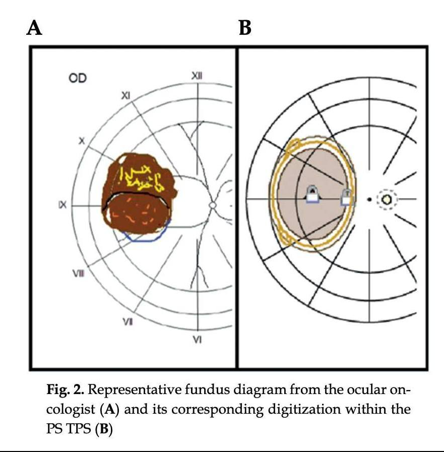 Clinical determination to use this technique should be performed on an individual basis, and additional QA steps are required.
termedia.pl/Dual-source-st…