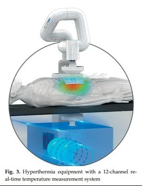 In the current study, the clinical efficacy of iodine-125 (125I) radioactive particle implantation with deep hyperthermia in malignant tumor treatment was retrospectively analyzed.
termedia.pl/Clinical-effic…