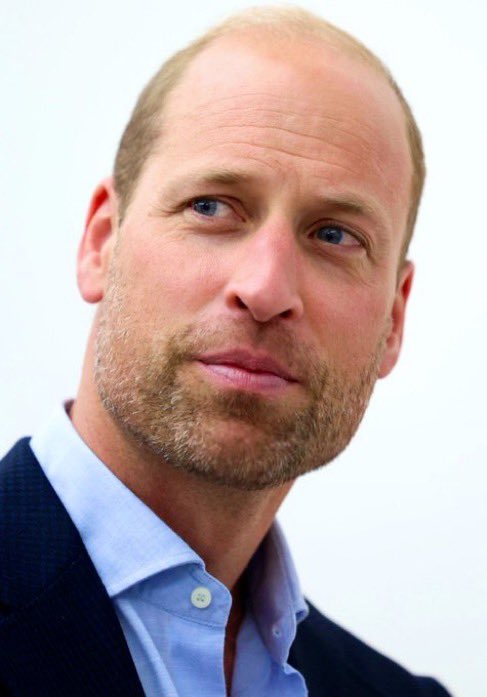 Prince William will never need Photoshop, bald or not🔥
His close up pictures with his aging lines and left scar tell a beautiful story👌
#PrinceofWales 
#DukeofCornwall