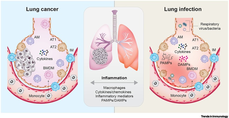 Lung tumor immunity: redirecting macrophages through infection-induced inflammation dlvr.it/TLK3c9