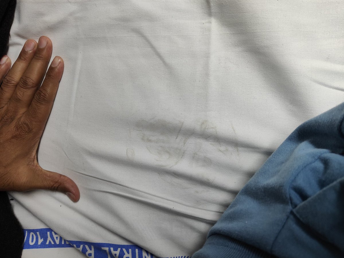 ShankDhanke's tweet photo. @IRCTCofficial   To Indian Railway, my berth no. B2 54, train (22118) , the bed sheet was already dirty when I unfold them to lay on the seat. https://t.co/b3LIZ4xn5A