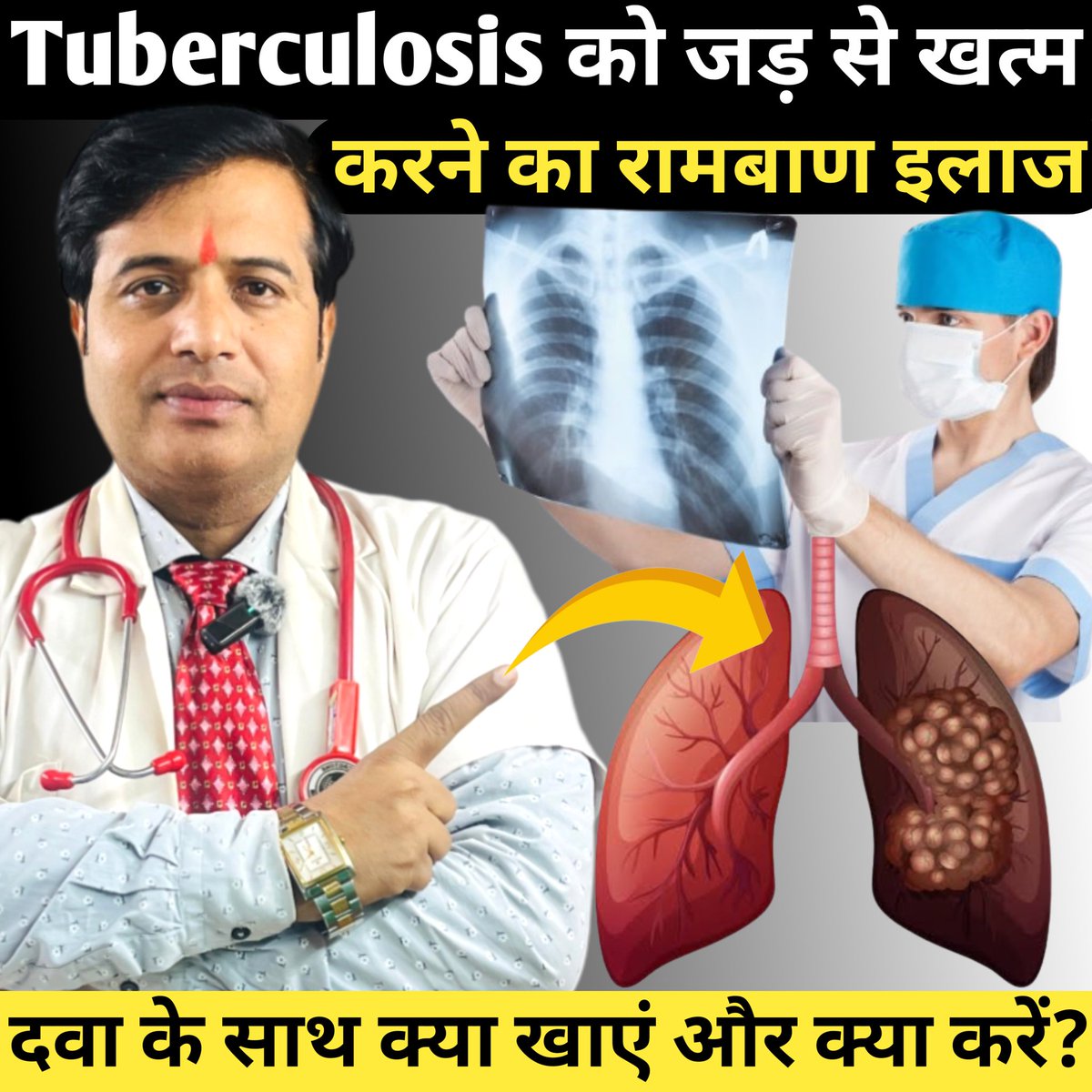 Full video on <a href="/YouTube/">YouTube</a> Link given in bio #tuberculosis