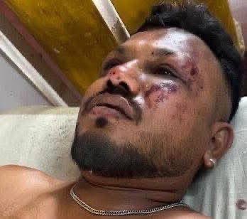 जिसे ऊपर वाला बचा देता है . उसे कुछ न्ही होता . प्लेन ख़त्म. जिससे टकराया वो बिल्डिंग ख़त्म. लेकिन ये आदमी 11A पर बैठा आदमी बच गया. यही प्रभु की लीला है #planecrash #AhmedabadPlaneCrash #BreakingNews