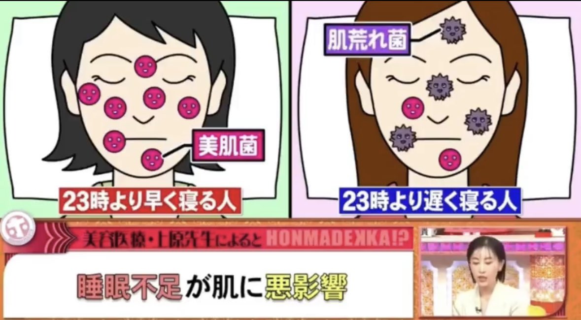 睡眠不足になると「肌に悪い菌」が増えるらしい…🦠💔
（アクネ菌とか増殖するって怖すぎ😇）

どんなに高級スキンケア使ってても、寝不足じゃ肌フローラ乱れるし、
“菌活＝美肌”ってこと改めて実感した😴💆‍♀️💭