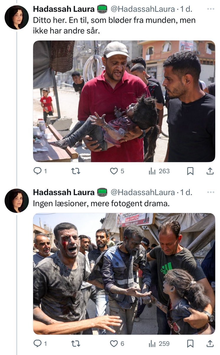 Indre blødninger skyldes trykbølges skader organer. Blod i munden kommer fra skadede lunger og luftveje.
Det er det folk primært dør af ved en bombe

Er du et monster eller blot særligt udvalgt af gud? <a href="/HadassahLaura/">Hadassah Laura 📟</a> 

Simpelthen rystende kommentar til et billede af et barn