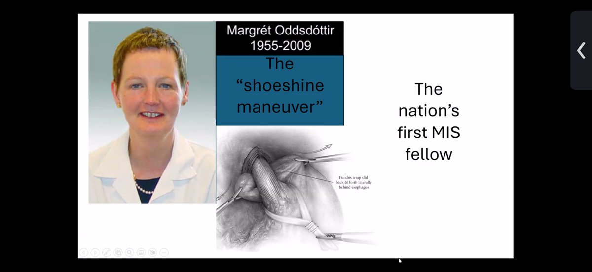 GAEscobarMD's tweet image. Fantastic grand rounds @EmorySurgery kicking off our celebrations for our 100th anniversary.
John G Hunter recounted Emory&apos;s role in starting the first minimally invasive fellowship program in the country.
He gave a special shout out to @AlanLumsdenMD as innovator in MIS!