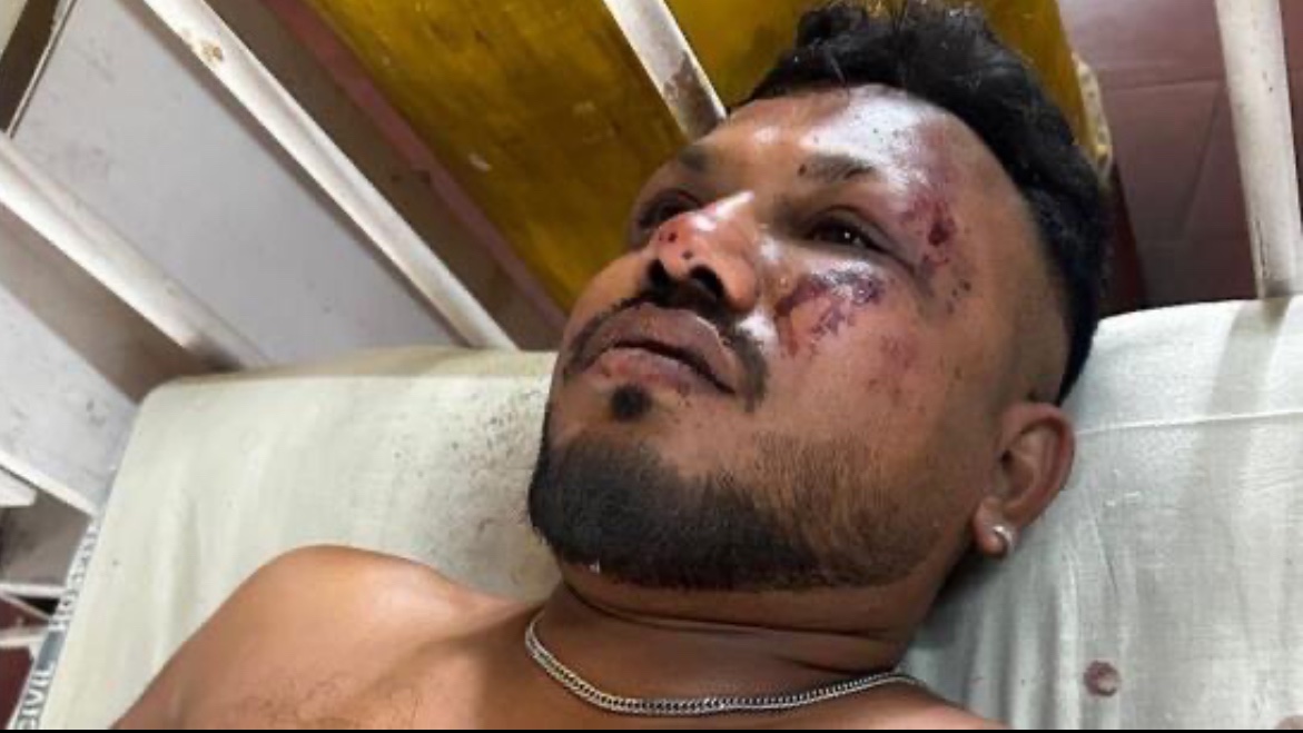 anshuma89204143's tweet photo. #planecrash
CONFIRMED: One miraculous survivor in the #PlaneCrash, Vishwash Kumar Ramesh, Seat 11A 🥳

He recalls a loud boom just 30 seconds after takeoff. The plane nosedived. He survived. STOOD UP. WALKED OUT. 
~ God has plans 🙏🏼 https://t.co/pk2zTyKNdu