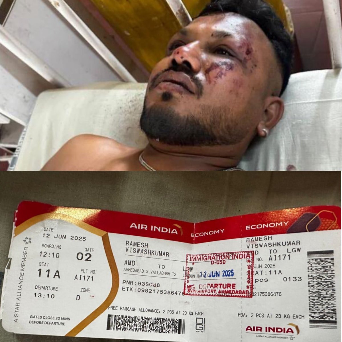 MILAGRO Viswashkumar Ramesh, “ciudadano británico”, es el único sobreviviente conocido del vuelo 171 de Air India.
“Treinta segundos después del despegue, se escuchó un ruido fuerte y luego el avión se estrelló. Todo sucedió muy rápido. Cuando subí, había cuerpos a mi alrededor"