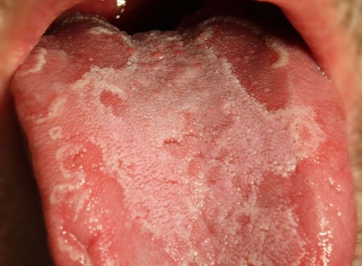 kabigwa_78's tweet image. “ALLERGY INAWEZA KUKUUA DAKIKA 5 TU… LAKINI WENGI WANAICHUKULIA KAMA MZAA MZAA TU!”

Uzi mrefu wa kusisimua, kuelimisha, na kuogofya kuhusu ALLERGY — adui hatari anayeishi kimya kimya ndani ya miili yetu 

🧵👇🏾