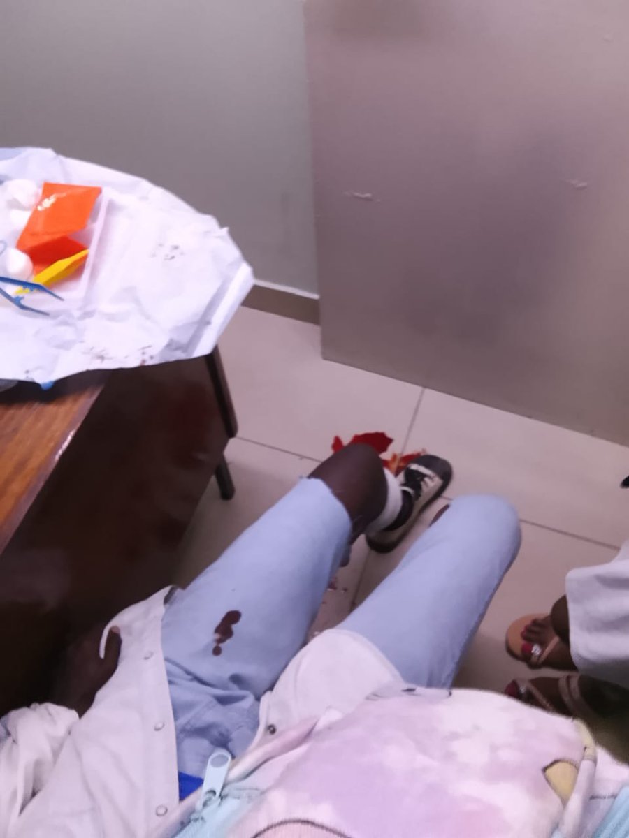 Girlstowomenke (@girlstowomenke) on Twitter photo Police Brutality casualties.
We witnessed and received reports of Youth casualties in the Ongoing protests in Kenya in quest for #JusticeForAlbertOjwang.
Lucy Nelima was shot at Harambee Avenue #JusticeForAlbertOjwang #justiceforall #EndPoliceBrutality <a href="/UAFAfrica/">UAF-Africa</a> Police Brutality casualties.
We witnessed and received reports of Youth casualties in the Ongoing protests in Kenya in quest for #JusticeForAlbertOjwang.
Lucy Nelima was shot at Harambee Avenue #JusticeForAlbertOjwang #justiceforall #EndPoliceBrutality <a href="/UAFAfrica/">UAF-Africa</a>