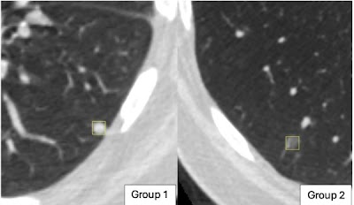 Radiology: Artificial Intelligence tweet media