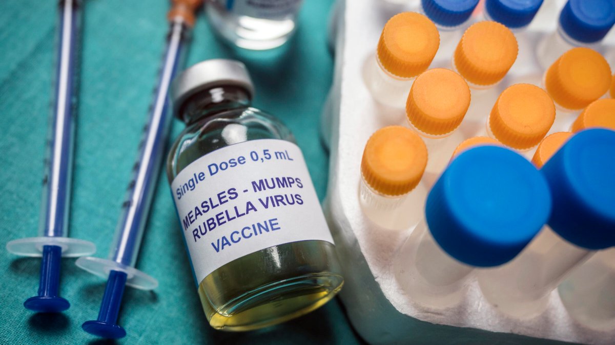 JHU Advanced Academic Programs (@jhuaap) on Twitter photo A new county-level dataset from <a href="/JohnsHopkins/">Johns Hopkins University</a> researchers reveals a national decline in the measles-mumps-rubella vaccination rate among children since the start of the COVID-19 pandemic. Out of 2,066 studied counties, 78% reported drops in vaccinations. bit.ly/4kMarE5 A new county-level dataset from <a href="/JohnsHopkins/">Johns Hopkins University</a> researchers reveals a national decline in the measles-mumps-rubella vaccination rate among children since the start of the COVID-19 pandemic. Out of 2,066 studied counties, 78% reported drops in vaccinations. bit.ly/4kMarE5