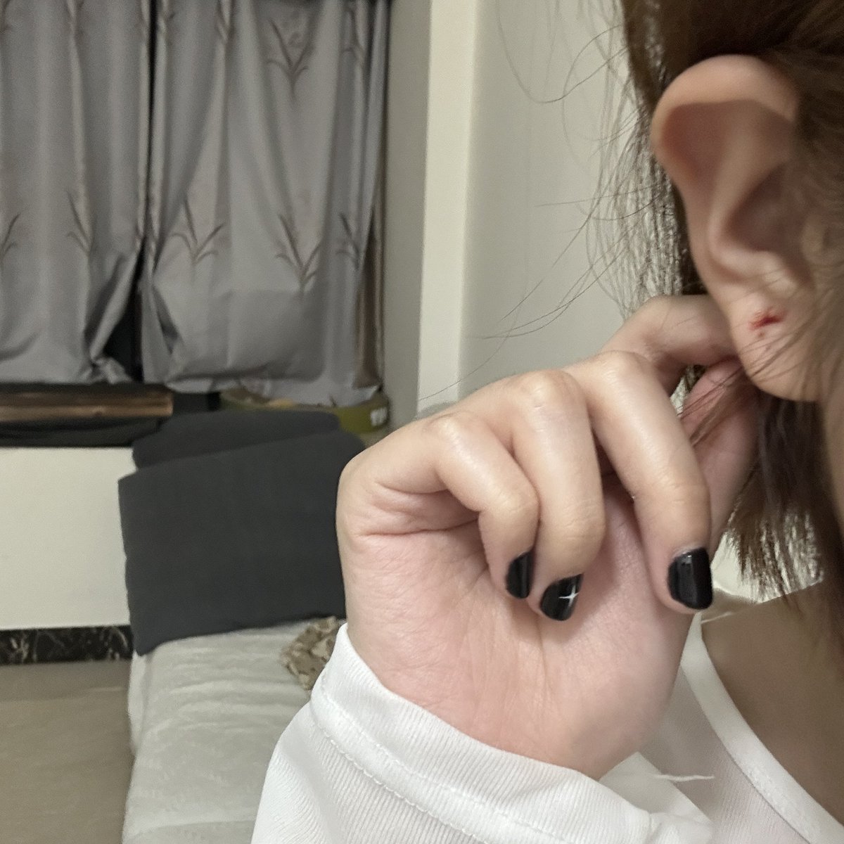 被朋友的猫打耳洞了🙂‍↔️