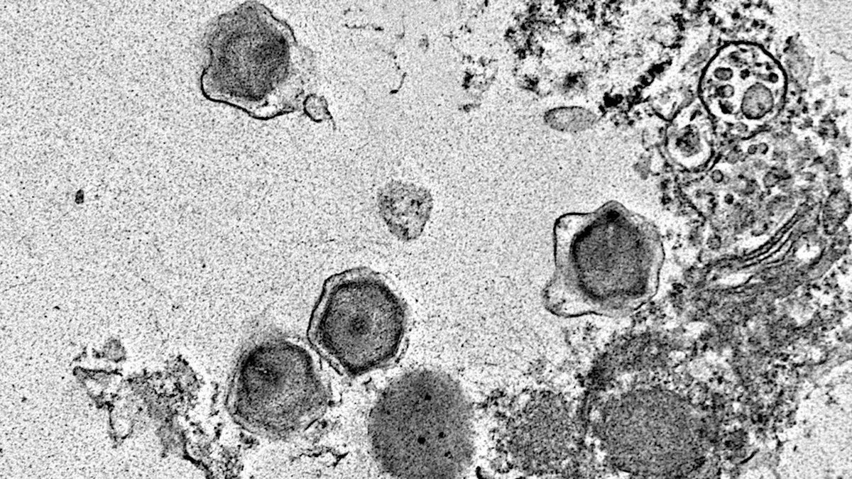 230 New Giant Viruses Discovered That Shape Earth's Oceans
astrobiology.com/2025/06/230-ne… #astrobiology #virus #genomics #oceanography
