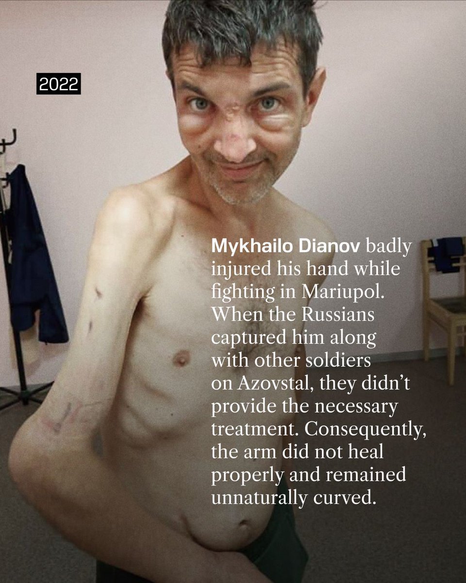 You saw his photos after Russian captivity, now he shares a new one.