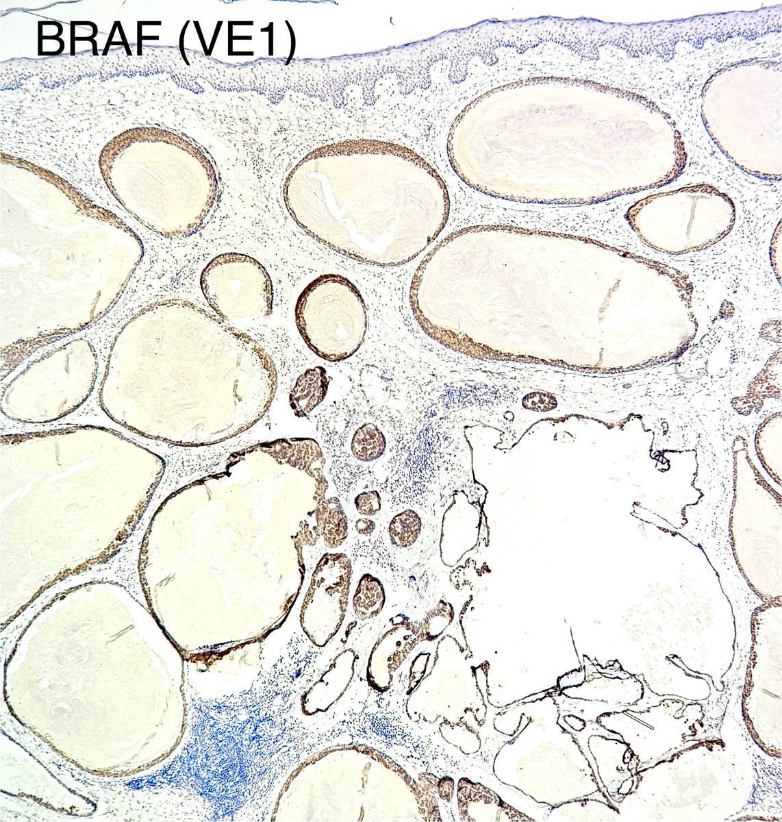 Francesco Fortarezza tweet media