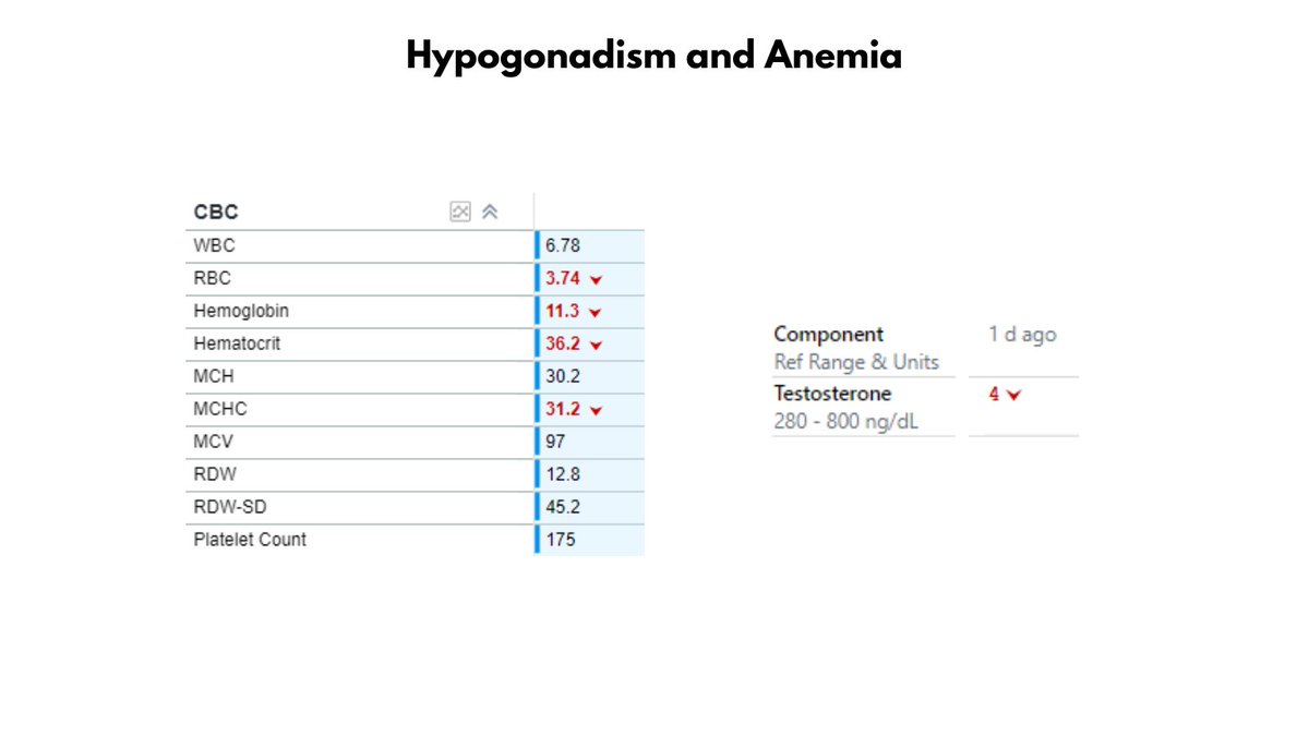 1/2

HYPOGONADISM AND ANEMIA

86M otherwise well, presented with ++fatigue and normocytic normochromic anemia (Hb 11.3) No evidence of liver/kidney disease, inflammation, hypothyroidism or nutritional deficiency.

So, I decided to check a testosterone - virtually undetectable!